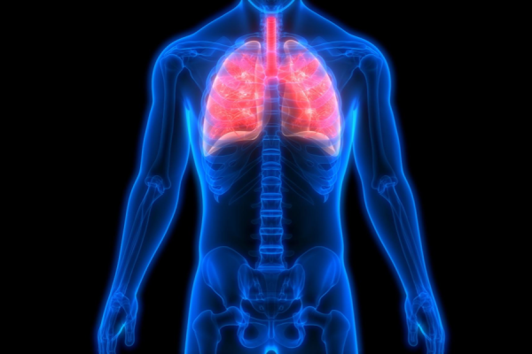 Nutritional Support in Acute Respiratory Distress Syndrome (ARDS)